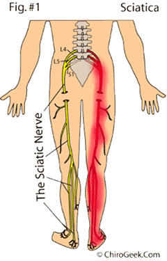 illustration of sciatic nerve