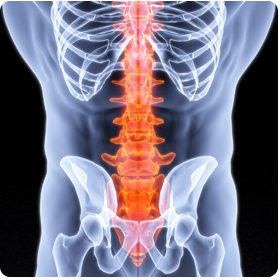 Laser Therapy to relieve YOUR back pain